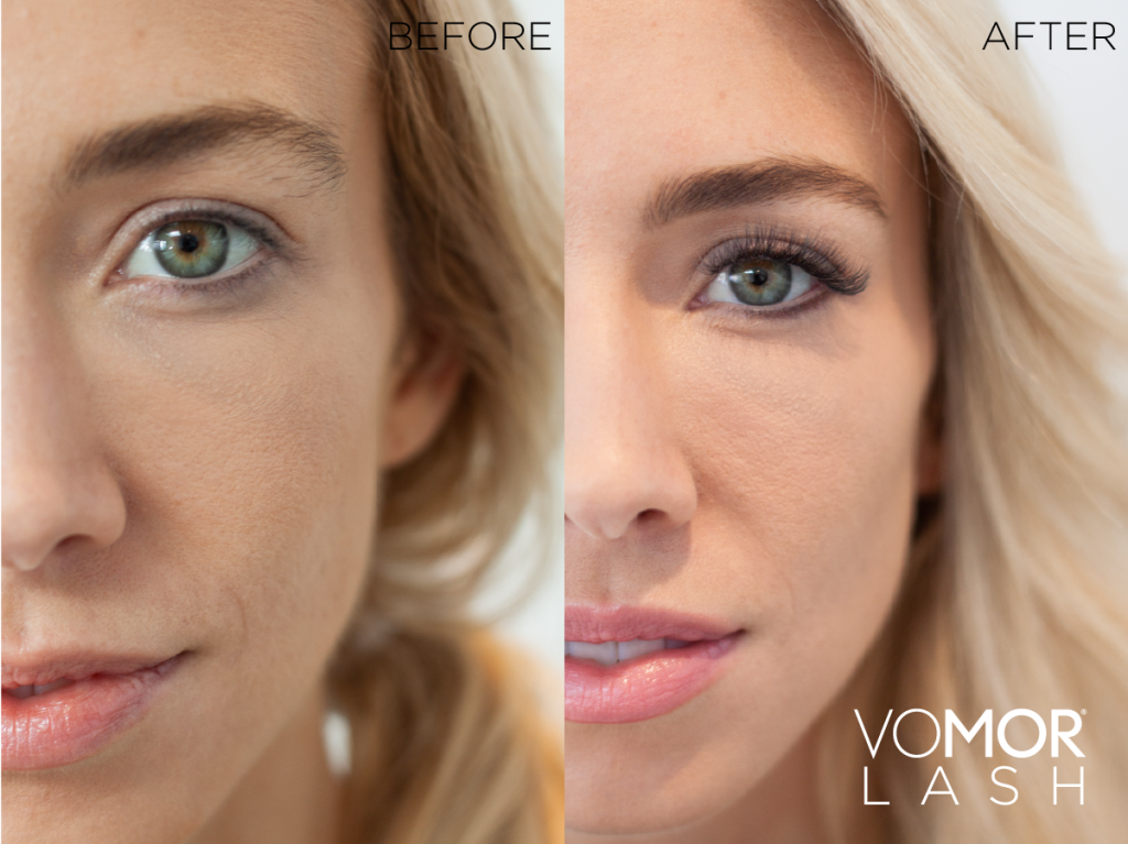VoMor-Lash-Extentions-before-after-1024×767